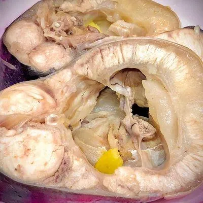 Bước 2